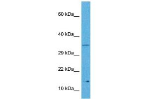 Host:  Rabbit  Target Name:  MYCNOS  Sample Tissue:  Human Hela Whole Cell  Antibody Dilution:  1ug/ml (MYCNOS antibody  (N-Term))