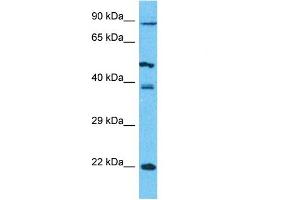 Host:  Rabbit  Target Name:  PCDHB5  Sample Type:  293T Whole Cell lysates  Antibody Dilution:  1. (PCDHb5 antibody  (N-Term))
