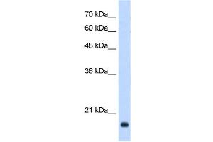 GADD45B antibody used at 0.