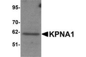 Western blot analysis of KPNA1 in Hela cell lysate with KPNA1 antibody at 1μg/ml.