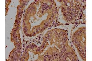 Trichohyalin antibody  (AA 1922-1941)