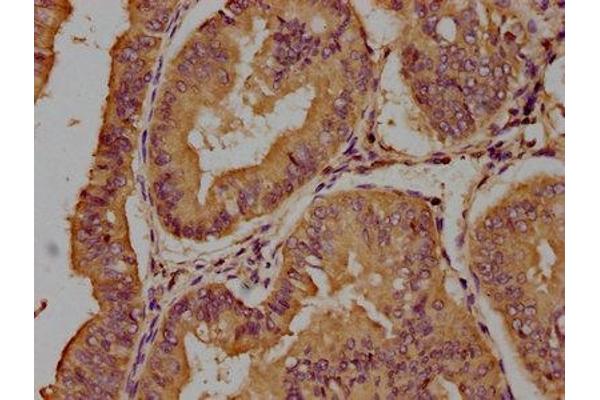Trichohyalin antibody  (AA 1922-1941)