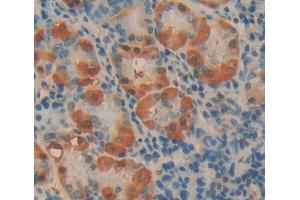 Used in DAB staining on fromalin fixed paraffin- embedded stomach tissue (Phospholipase C beta 2 antibody  (AA 1-250))