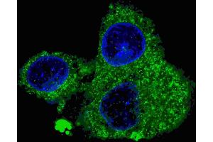 Fluorescent confocal image of HepG2 cells stained with FASN (Center) antibody.