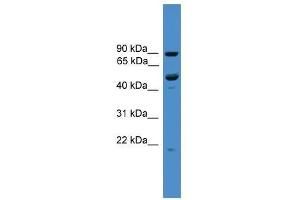 Western Blot showing C3orf59 antibody used at a concentration of 1-2 ug/ml to detect its target protein. (MB21D2 antibody  (C-Term))