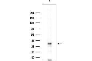 anti-PDLIM1 Interacting Kinase 1 Like (PDIK1L) (Internal Region) antibody