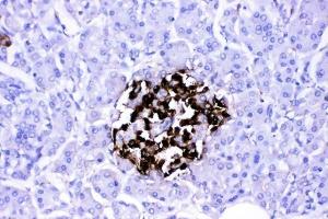 IHC analysis of VIP using anti-VIP antibody (ABIN4886760).