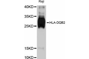 Western blot analysis of extracts of Raji cells, using HLA-DQB2 antibody (ABIN4903931) at 1:3000 dilution. (HLA-DQB2 antibody)