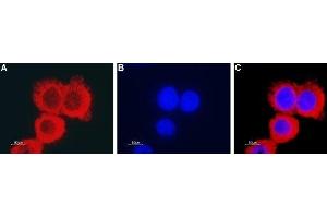 Expression of CLIC1 in human colorectal adenocarcinoma HT-29 cells - Immunocytochemical staining of fixed and permeabilized human colorectal adenocarcinoma HT-29 cells. (CLIC1 antibody  (Intracellular))