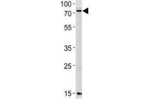 Western blot analysis of lysate from mouse NIH3T3 cell line using PAK3 antibody diluted at 1:1000 for each lane. (PAK3 antibody  (AA 124-152))