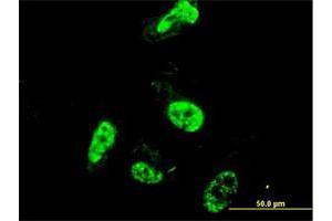 Immunofluorescence of monoclonal antibody to PML on HeLa cell. (PML antibody  (AA 411-510))
