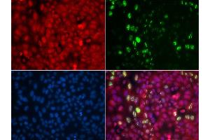 Immunofluorescence analysis of U2OS cells using Phospho-ABL1-Y204 antibody (ABIN5969866). (ABL1 antibody  (pTyr204))
