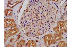 IHC image of ABIN7143836 diluted at 1:400 and staining in paraffin-embedded human kidney tissue performed on a Leica BondTM system. (ALDH7A1 antibody  (AA 386-515))