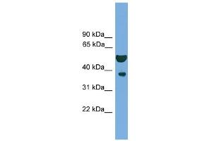 WB Suggested Anti-APEX1 Antibody Titration: 0. (APEX1 antibody  (N-Term))