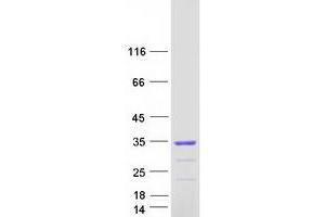 Western Blotting (WB) image for Non-SMC Element 1 Homolog (NSMCE1) protein (Myc-DYKDDDDK Tag) (ABIN2727646)