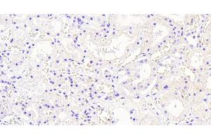 ABIN184795 Negative Control showing staining of paraffin embedded Human Kidney, with no primary antibody. (AKR1A1 antibody  (C-Term))