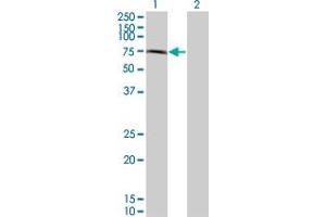 Western Blot analysis of CHFR expression in transfected 293T cell line by CHFR monoclonal antibody (M08), clone 2B11. (CHFR antibody  (AA 136-194))