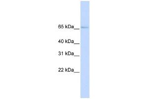 SLC22A6 antibody used at 1 ug/ml to detect target protein.