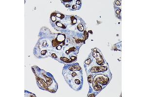 Immunohistochemistry of paraffin-embedded human placenta using Fibrinogen alpha chain (Fibrinogen alpha chain (FGA)) Rabbit pAb (ABIN7267178) at dilution of 1:100 (40x lens). (FGA antibody  (AA 1-100))