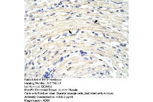 Human Muscle (KAT5 antibody  (N-Term))