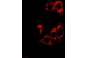 Immunofluorescent analysis of SHP staining in U2OS cells. (NR0B2 antibody)