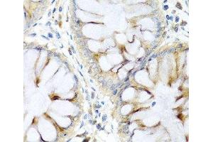 Immunohistochemistry of paraffin-embedded Human colon using PI3 Polyclonal Antibody at dilution of 1:100 (40x lens). (PI3 antibody)