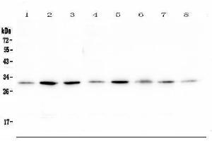 Western blot analysis of RPS3 using anti-RPS3 antibody (ABIN6719371). (RPS3 antibody)