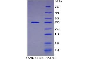 SDS-PAGE analysis of Human Gelsolin Protein. (Gelsolin Protein (GSN))