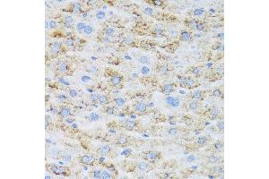 Immunohistochemistry of paraffin-embedded mouse liver using TIRAP antibody.