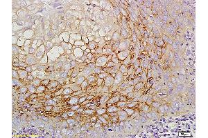 Formalin-fixed and paraffin embedded mouse intestine labeled with Anti CD44v5 Polyclonal Antibody, Unconjugated (ABIN680623) at 1:200 followed by conjugation to the secondary antibody and DAB staining (CD44RC (AA 61-139) antibody)