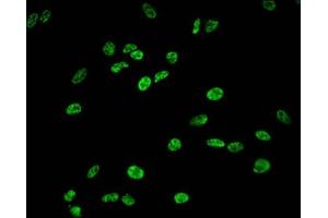 Immunofluorescent analysis of Hela cells using ABIN7139620 at dilution of 1:100 and Alexa Fluor 488-congugated AffiniPure Goat Anti-Rabbit IgG(H+L) (HIST1H1E antibody  (pSer35))