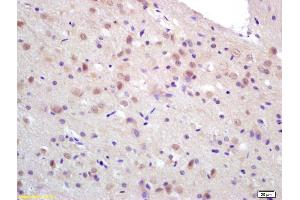 Formalin-fixed and paraffin embedded rat brain labeled with Rabbit Anti CCDC12 Polyclonal Antibody, Unconjugated (ABIN872486) at 1:200 followed by conjugation to the secondary antibody and DAB staining (CCDC12 antibody  (AA 19-120))