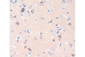 Used in DAB staining on fromalin fixed paraffin- embedded Kidney tissue (CA8 antibody  (AA 1-290))