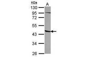 Image no. 1 for anti-1-Acylglycerol-3-Phosphate O-Acyltransferase 5 (Lysophosphatidic Acid Acyltransferase, Epsilon) (AGPAT5) (AA 45-264) antibody (ABIN1496496) (AGPAT5 antibody  (AA 45-264))