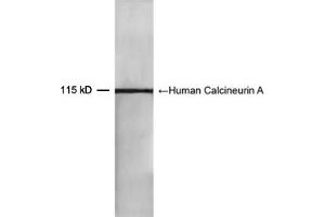 Western blot analysis of recombinant human Calcineurin A protein using 0. (Calcineurin A antibody  (AA 450-500))