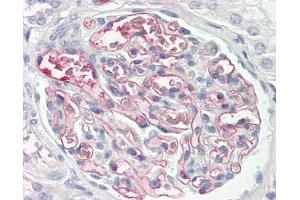 Image no. 1 for anti-C4b-Binding Protein antibody (ABIN957838) (C4BP antibody)