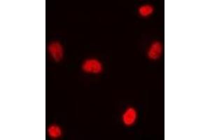 Immunofluorescent analysis of RNF8 staining in MCF7 cells. (RNF8 antibody)