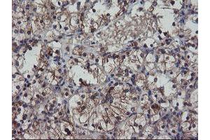 Image no. 1 for anti-Prefoldin Subunit 3 (PFDN3) antibody (ABIN1501705) (VBP1 antibody)