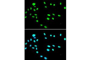 Immunofluorescence analysis of A549 cells using RUVBL1 antibody. (RUVBL1 antibody)