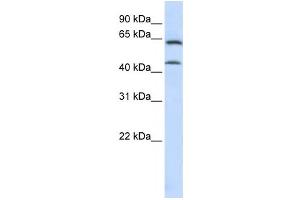 Western Blotting (WB) image for anti-Chondroitin Sulfate N-Acetylgalactosaminyltransferase 1 (CSGALNACT1) antibody (ABIN2459114) (CSGALNACT1 antibody)