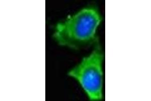 Immunofluorescent analysis of Hela cells using ABIN7159413 at dilution of 1:100 and Alexa Fluor 488-congugated AffiniPure Goat Anti-Rabbit IgG(H+L) (Merlin antibody  (AA 230-414))