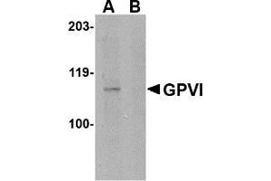 Western Blotting (WB) image for anti-Glycoprotein VI (Platelet) (GP6) (Middle Region) antibody (ABIN1030943)