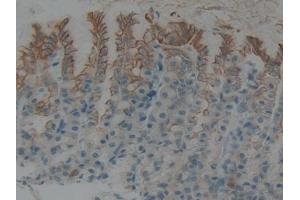 Detection of CK5 in Rat Stomach Tissue using Polyclonal Antibody to Cytokeratin 5 (CK5) (Cytokeratin 5 antibody  (AA 335-473))