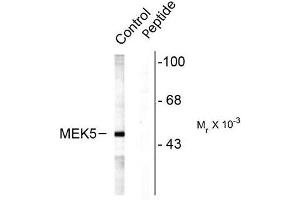 Image no. 1 for anti-Mitogen-Activated Protein Kinase Kinase 5 (MAP2K5) (pSer311), (pThr315) antibody (ABIN372667) (MAP2K5 antibody  (pSer311, pThr315))