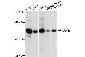 Western blot analysis of extracts of various cell lines, using PARVB antibody. (Parvin, beta antibody)