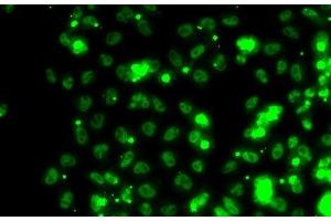 SECISBP2 antibody