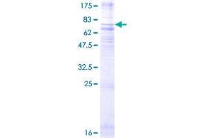 Image no. 1 for Neuromedin U Receptor 1 (NMUR1) (AA 1-426) protein (GST tag) (ABIN1312732) (NMUR1 Protein (AA 1-426) (GST tag))