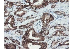 Image no. 11 for anti-FXYD Domain Containing Ion Transport Regulator 3 (FXYD3) antibody (ABIN1498341)