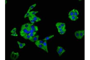 Immunofluorescence staining of HepG2 cells with ABIN7160125 at 1:66, counter-stained with DAPI. (Moesin antibody  (AA 466-572))