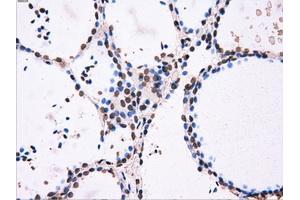 Image no. 3 for anti-ATP Synthase, H+ Transporting, Mitochondrial F1 Complex, beta Polypeptide (ATP5B) antibody (ABIN1496766) (ATP5B antibody)